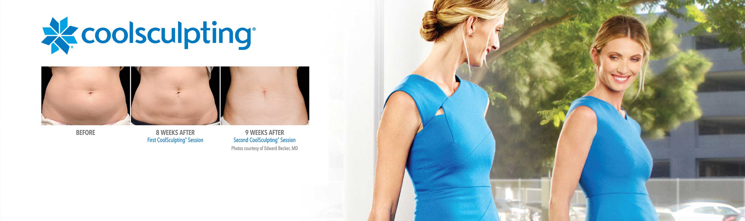 home-page-coolsculpting